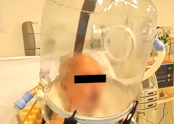 Tratamento para pacientes com covid-19 em Franca tem uso de bolha de respiração