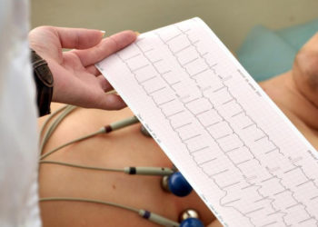 Mutirão de exames de pacientes na fila de espera retoma nesta sexta