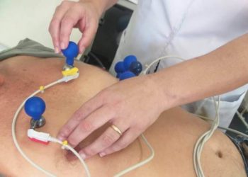 Parte de cadastrados para mutirão de exame de eletrocardiograma não comparece