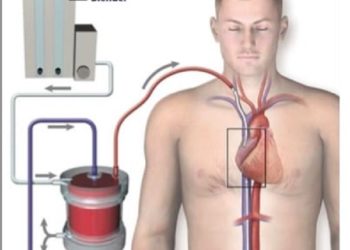 Como o pulmão artificial pode ajudar a salvar vidas de pessoas com covid-19?