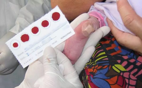 Foto: Nupad/Faculdade de Medicina da UFMG/Divulgação