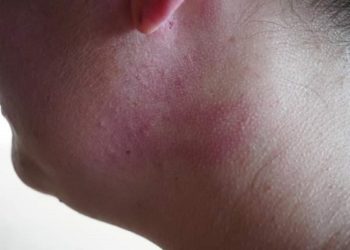 Advogada agredida em Rifaina revela ameaças sofridas: ‘Bato, bato mesmo, bato no marido, e bato nela, sua vagabunda’