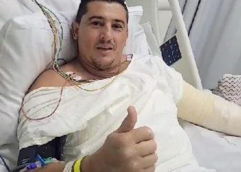 Dono de auto elétrica no Jardim Guanabara recupera-se de queimaduras sofridas após tentar salvar veículos