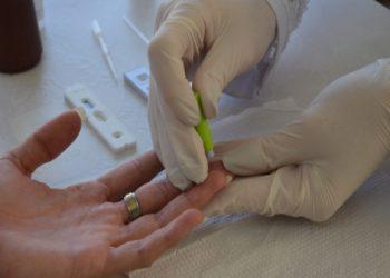 Saúde disponibiliza testes rápidos e gratuitos de hepatites no ‘Julho Amarelo’