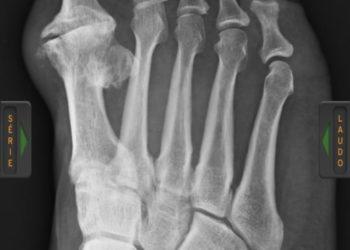 Sem conseguir operar na saúde pública de Franca, supervisor pede ajuda por Whatsapp para operação