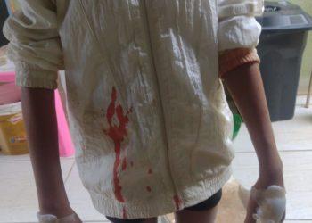 Cadela vive solta em terreno baldio no Polo Clube e ataca criança