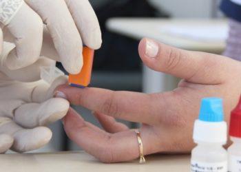 Incidência de Aids em Franca cai 30% e cidade está com testagem gratuita